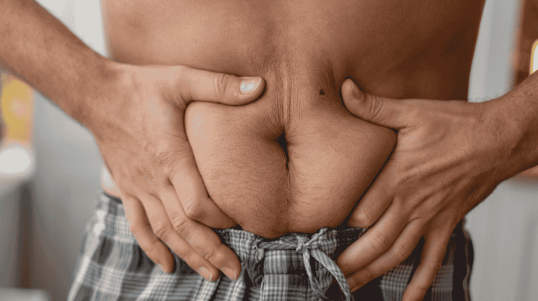 (Part 1) The Fat You Can't Always See: MASLD & Visceral Adiposity Featured image