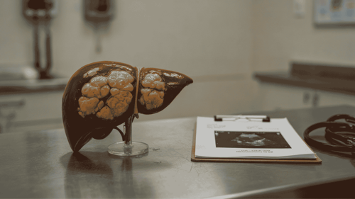 MAFLD: The Hidden Condition Behind Fatty Liver & What You Can Do featured image
