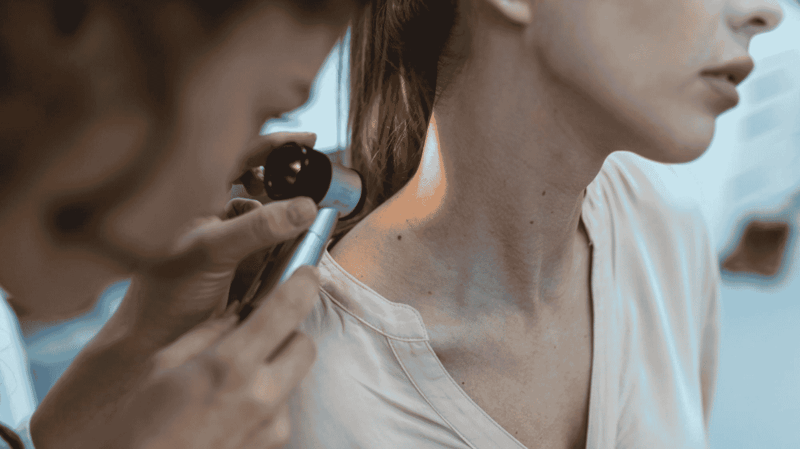 viral-warts-hpv