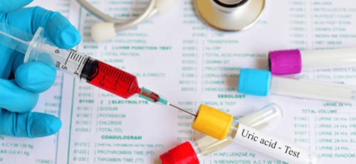 Uric Acid Levels: Normal Range, Symptoms & Dietary Tips featured image