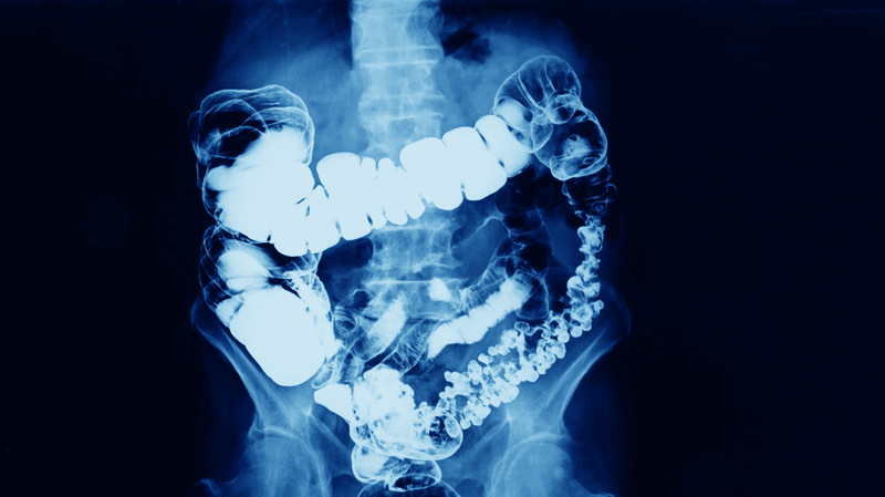 contrast-agent in the gut