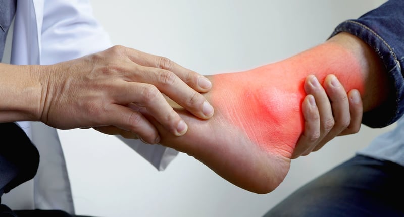 doctor checking for gout