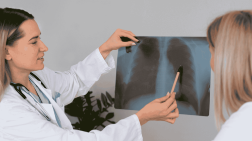 Why HK Non-Smokers Get Lung Cancer: Pollution & Risks featured image