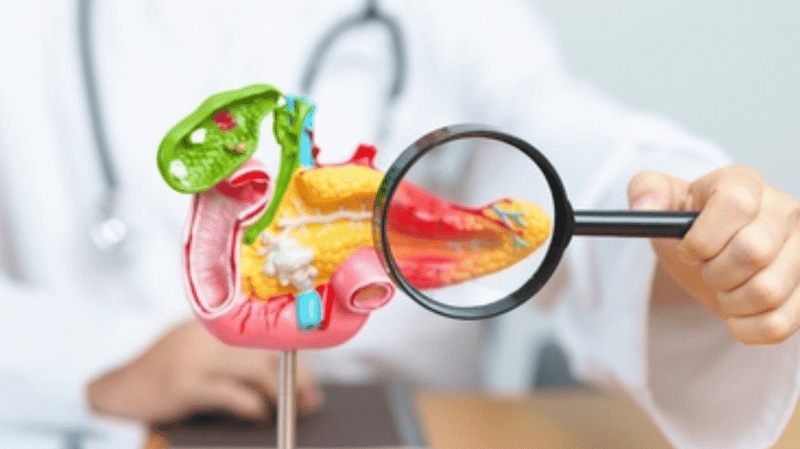 Pancreatectomy 