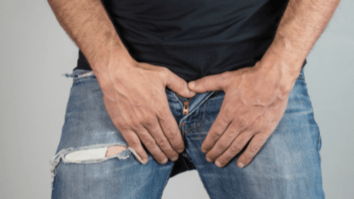 Redundant Prepuce: Causes and Modern Treatments featured image