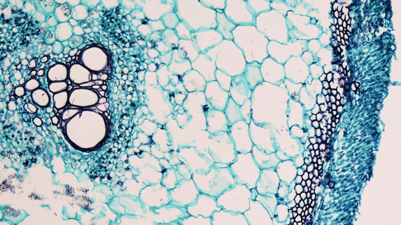Stem cell therapy