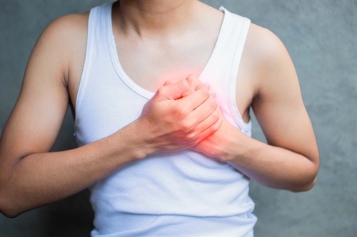 Tachycardia