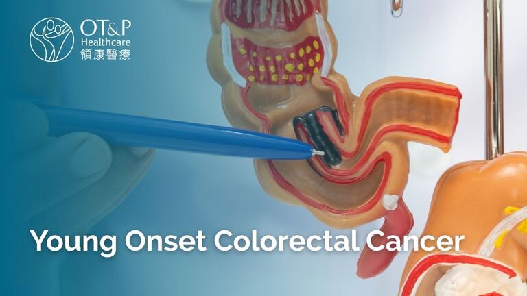 Young Onset Colorectal Cancer