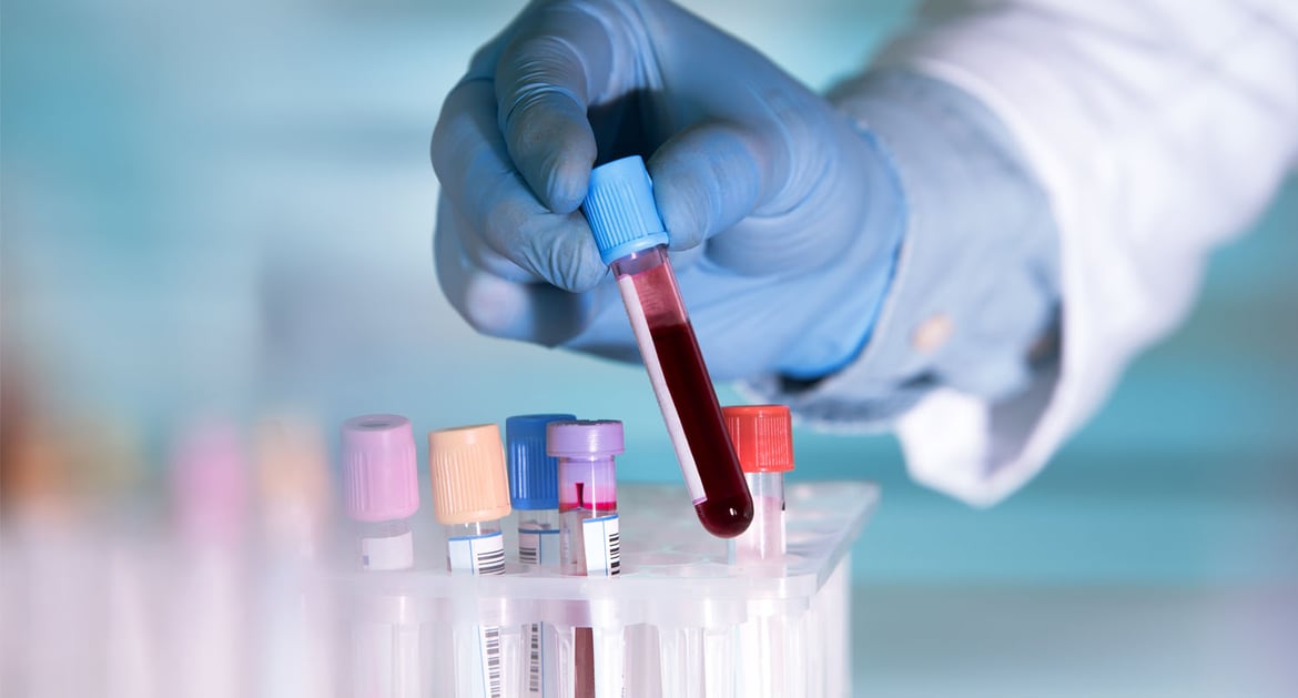 接種疫苗後抽取血液進行抗體測試