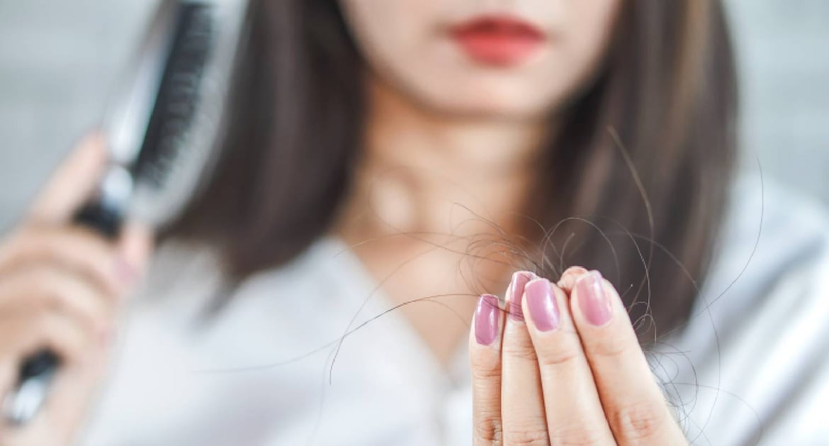 出現脫髮情況的年輕女性