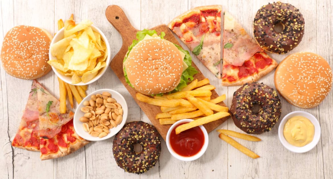 含膽固醇的垃圾食物