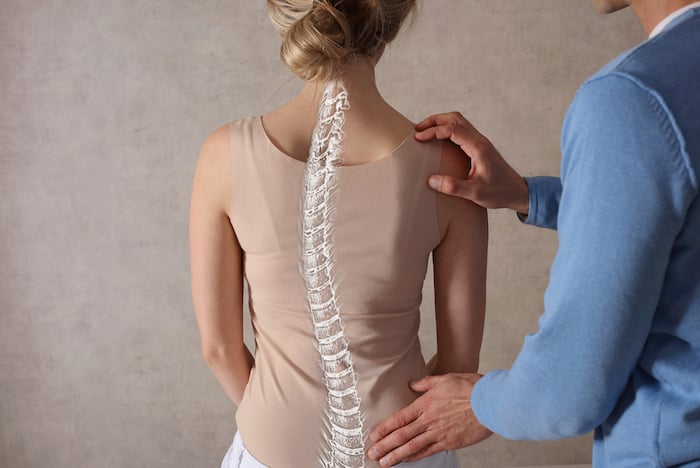 scoliosis spine curve