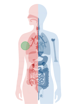 img-liquid-biopsy-cancer-chart-breast-cancer