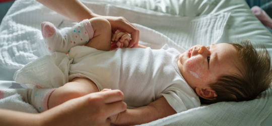 家長照顧濕疹BB