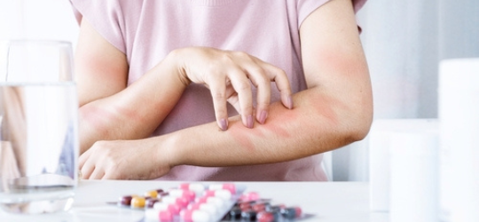 抵抗力差免疫系統失調紅疹