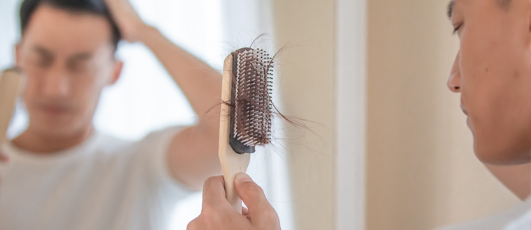 男士發現自己出現脫髮問題