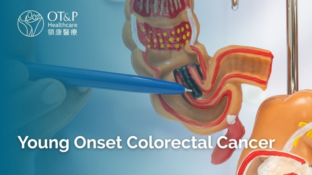 Young Onset Colorectal Cancer