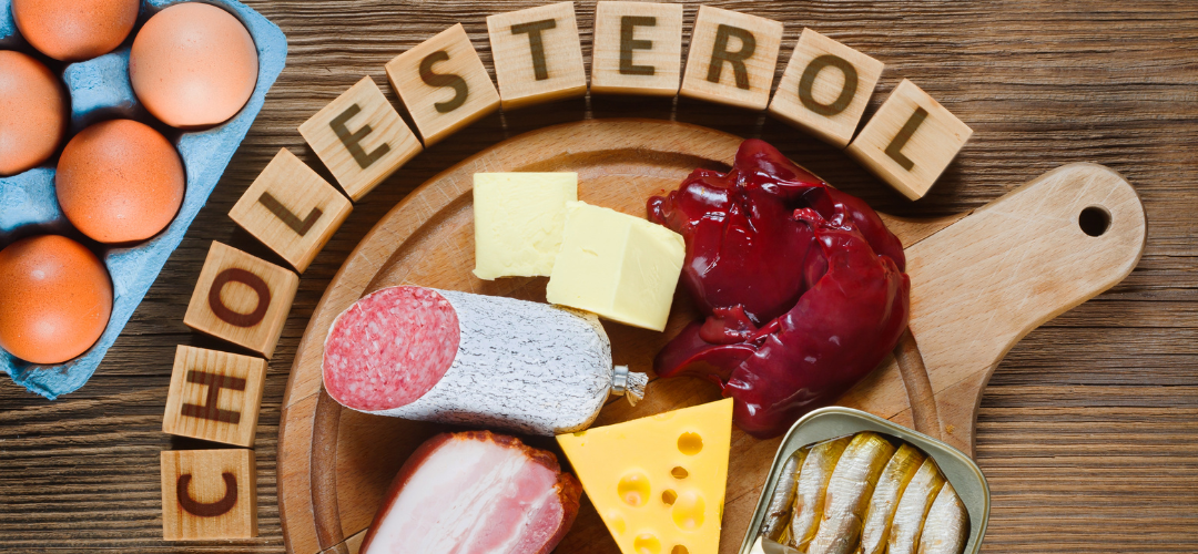 Cholesterol