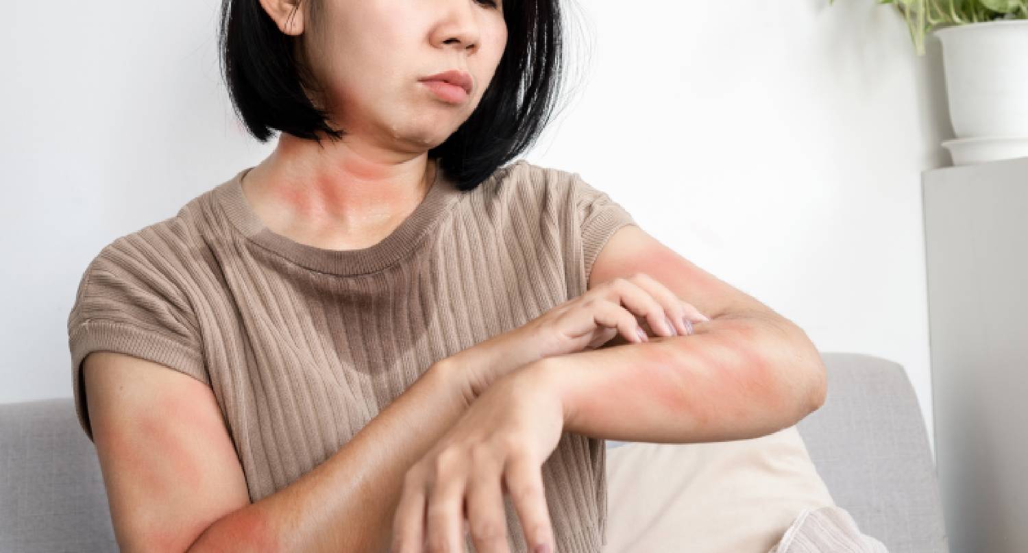 婦女感到皮膚痕癢