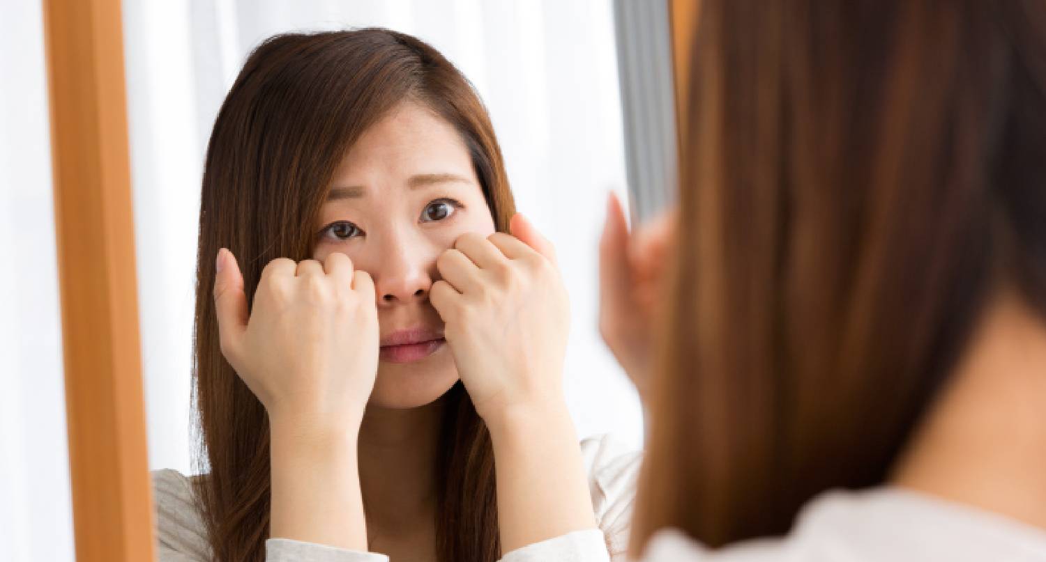 擔心自己眼皮下垂的女性